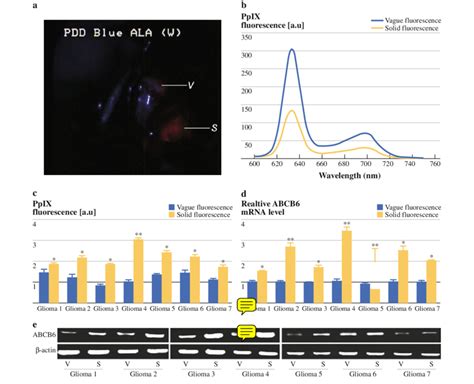 Abcb6 Mrna Expression In Solidly Fluorescing Tumors Was Higher Than