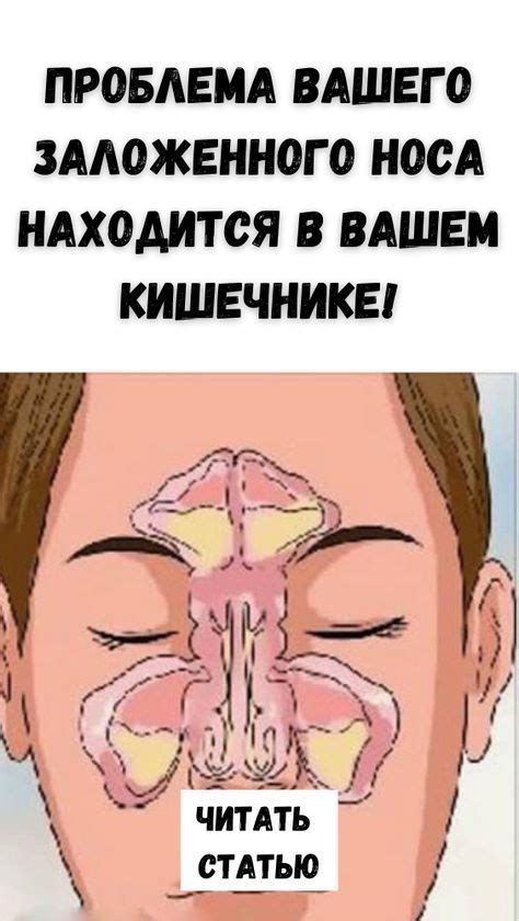 Супер-метод от заложенного носа. Уже на утро будете дышать свободно ...