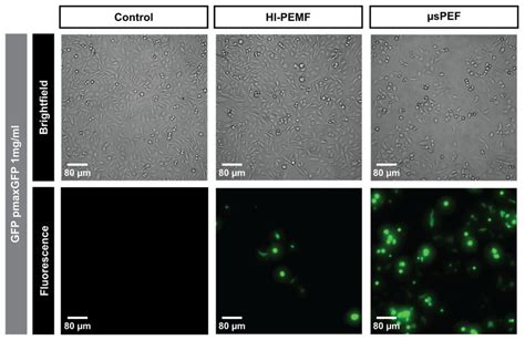 The Expression Of Green Fluorescent Protein After The Application Of