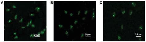 Figure From Effect Of Stat Decoy Oligodeoxynucleotides Mediated By