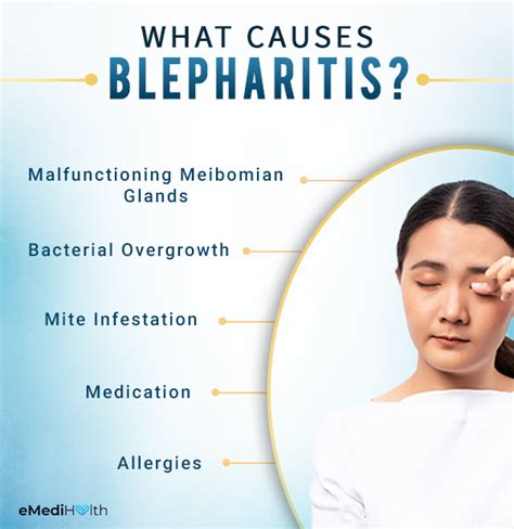 Blepharitis: Types, Causes, Symptoms, and Medical Treatment