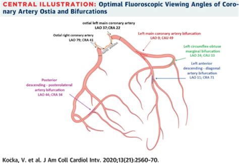 Procedural Techniques II Ostial And Bifurcation Lesions Flashcards