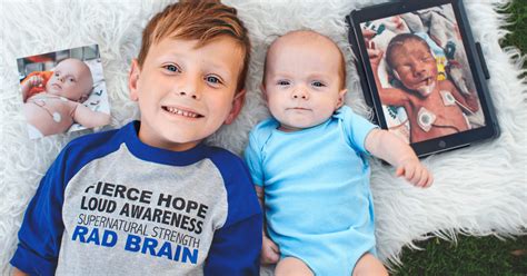 Hydrocephalus In Infants And Children Hydrocephalus Association