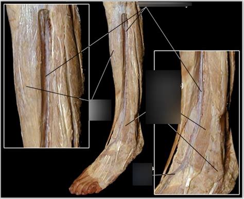 Lower Limb 1 Diagram Quizlet