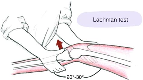 Fig Lachman Test Skills In Rheumatology Ncbi Bookshelf