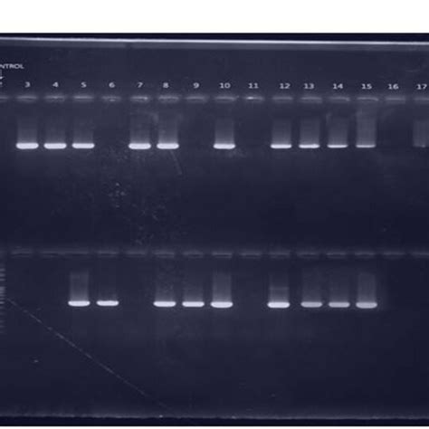 2 Agarose Gel Electrophoresis Analysis Of Pfmdr1 Gene Snps At Codon