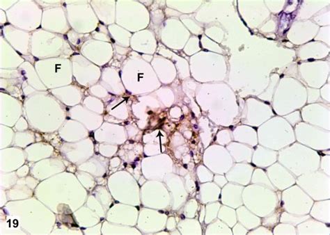 A Photomicrograph Of A Section Of The Adipose Tissue Of ND Rat Showing