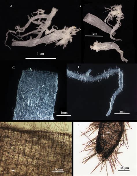 Leucosolenia Spicules