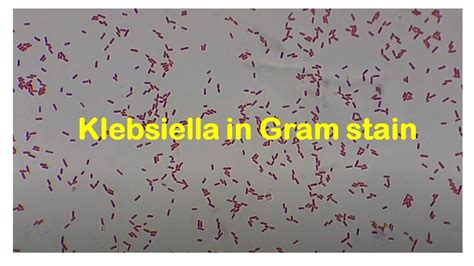 Klebsiella,Staphylococcus,E Coli,, 51% OFF