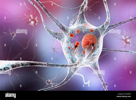 La Enfermedad De Parkinson Las C Lulas Nerviosas Equipo Ilustraci N De