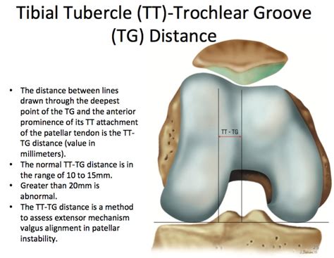 Trochlear Tubercle