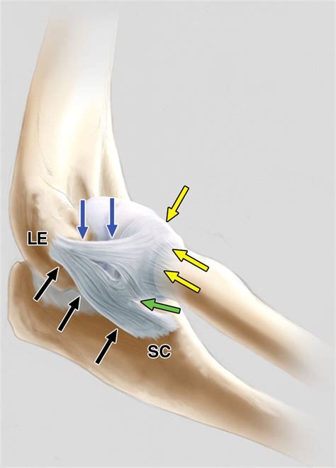 Sonography Of The Lateral Ulnar Collateral Ligament Of The Elbow Study