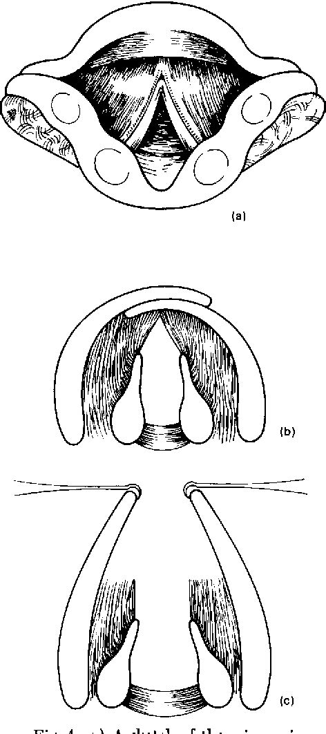 Figure 1 From Congenital Laryngeal Defects In The Adult Semantic Scholar