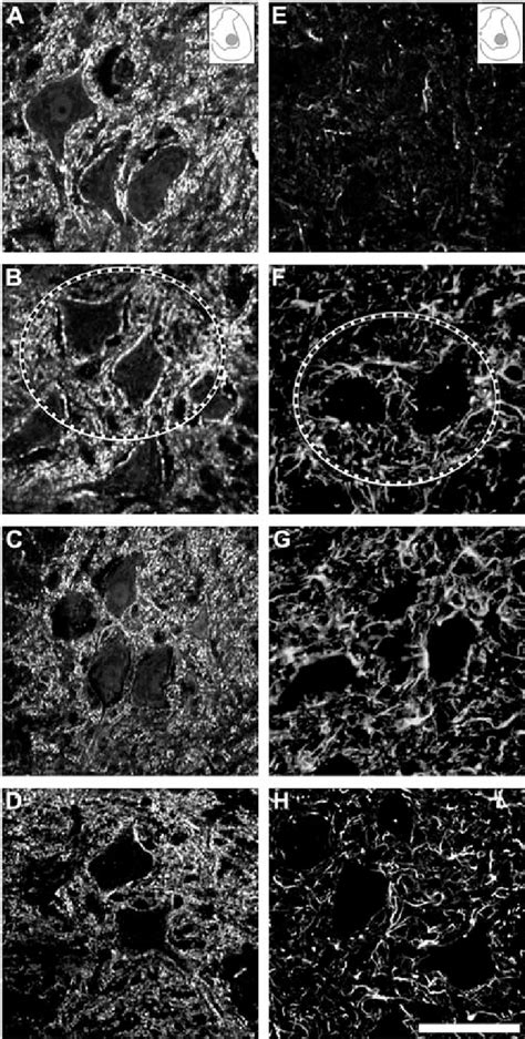 Photomicrographs Obtained At The Level Of The Spinal Cord Ventral Horn