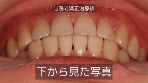 矯正歯科医が考える理想の噛み合わせとは