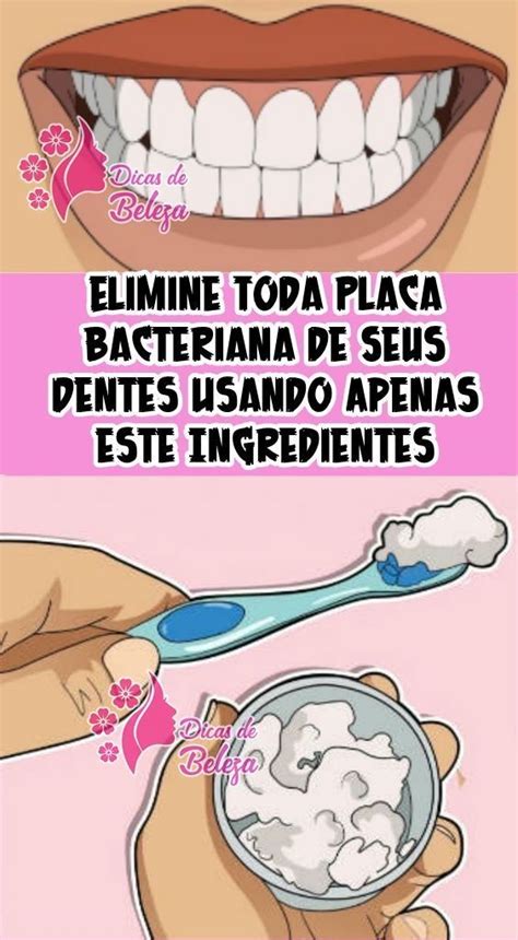 Rem Dios Caseiros Para Remover A Placa Bacteriana E O T Rtaro Dos