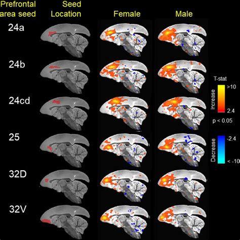 Seed Based Functional Connectivity In Various Medial Prefrontal Cortex