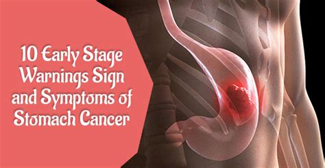 10 Early Stage warnings Sign and Symptoms of Stomach Cancer