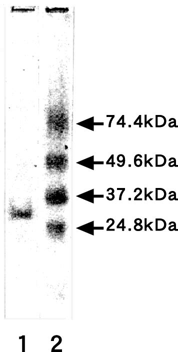 Figure 1 From Isolation And Characteristics Of Trypsin From Pyloric