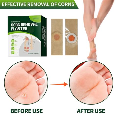Tebas Corn Removers 10 Pack - Corn & Callus Remover Patches with