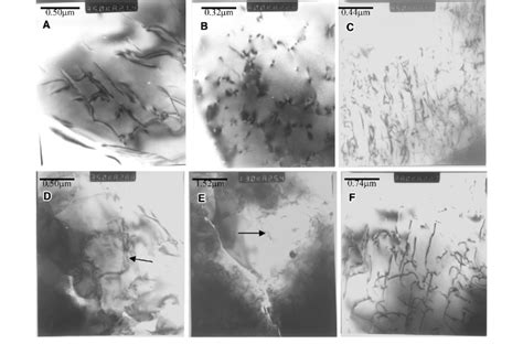 Tem Micrographs Of Dislocation At C A C Dislocations In