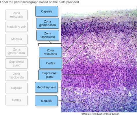 Label The Photomicrograph Based On The Hints Provided Suprarenal Gland