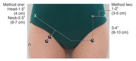 Bontrager Chapter 7 Femur And Pelvic Girdle Radiographic Positioning