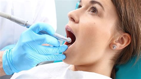 Understanding Dental Fillings What To Expect During The Procedure