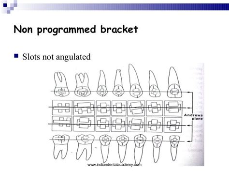 Brackets In Orthodontics Certified Fixed Orthodontic Courses By Indi