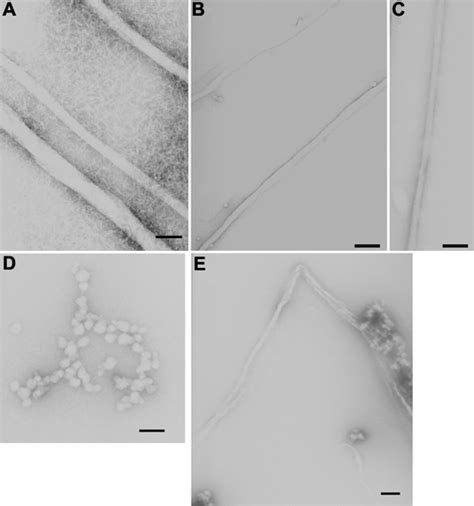 Electron Micrographs Of Fibrils Negatively Stained With Uranyl