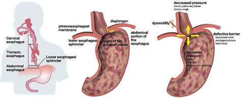 Esophagus Sphincter Anatomy