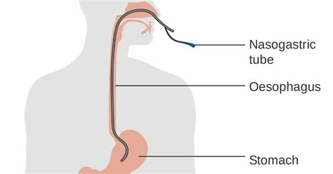 Ng Tube Diagram