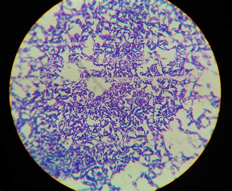 Gram Positive Bacilli With Spor Forming Stock Photo Image Of Microbe