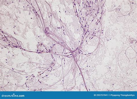 Motor Neuron, Spinal Cord, Nerve Fibres and Nerve Cells Under the ...