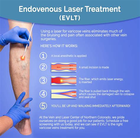 Evlt Nm Medical Laser Machine Endovenous Ablation Varicose Veins