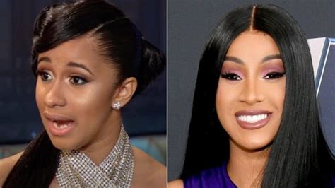 All about Cardi B Teeth Before and After - A Best Fashion