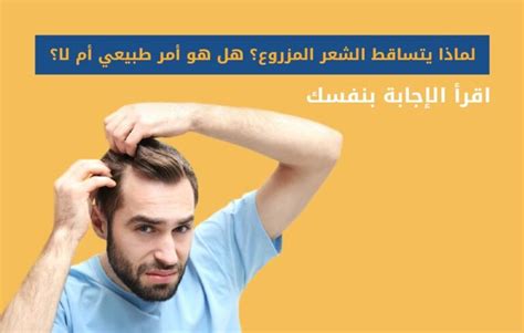 تساقط الشعر المزروع متى تقلق ومتى يكون جزءً من عملية الشفاء؟