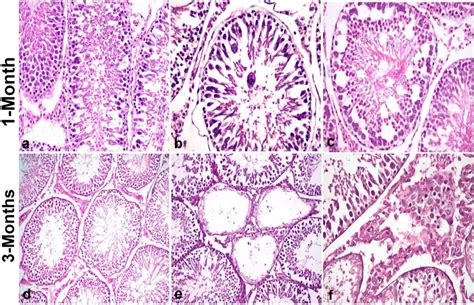 Photomicrograph Of Testicular Histological Sections Stained By Hande