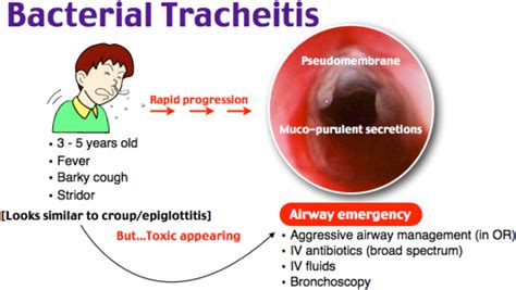 Rapid Review Bacterial Tracheitis