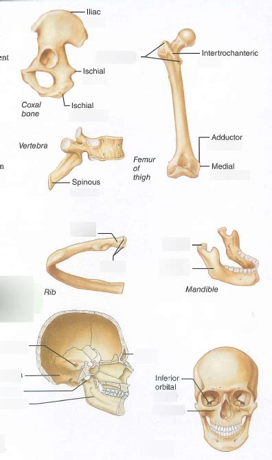 Facet Bone Marking