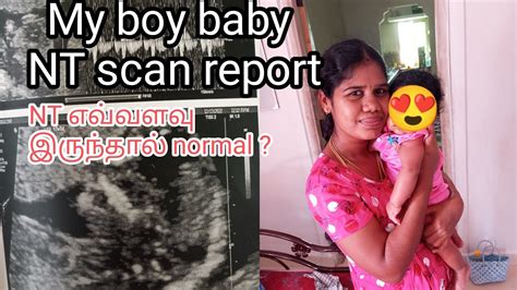 My Boy Baby NT Scan Report In Tamil 3 Month Scan Report YouTube