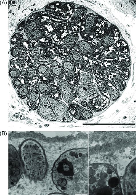 1 Ultrastructure Of A Toxoplasma Gondii Tissue Cyst In Vitro A This Download Scientific