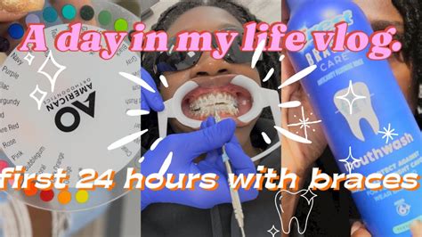 VLOG DAY IN THE LIFE Come Get Braces With Me First 24hours With