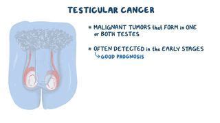 Testicular Torsion Reduction