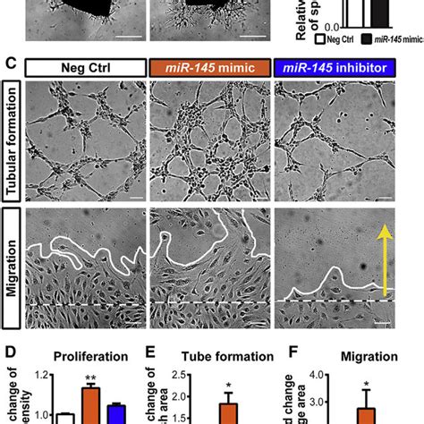 Proposed Role Of The MiR 145 TMOD3 Axis In Proliferative Retinopathy In