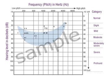 The Audiogram