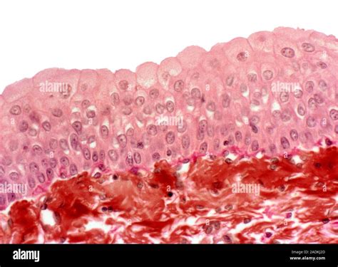 Bladder Epithelium Light Micrograph Of A Vertical Section Through The