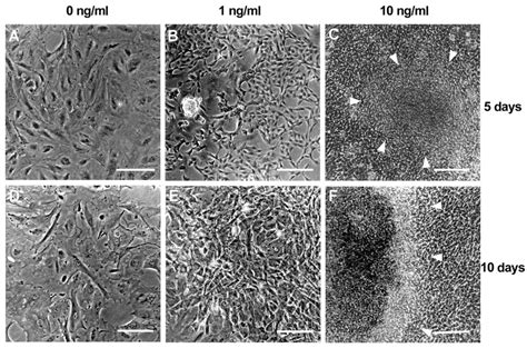 Effect Of Fgf On Neural Crest Cell Morphology Phase Contrast