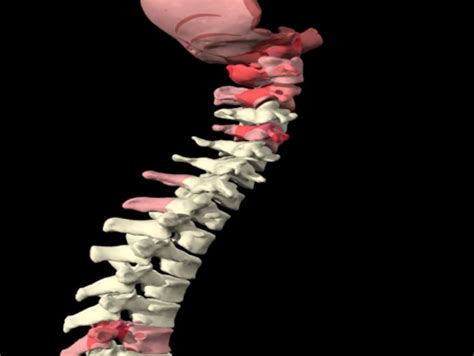 The Spine 5 Mid Lower Cervical Spine Joints And Motions Exam 4