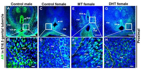 Distribution Of Androgen Receptors Ars In E Mouse Genital